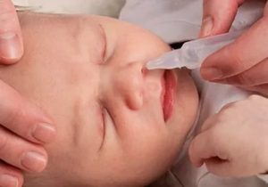 Как и чем вылечить заложенность носа у грудного ребенка