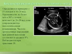 Что делать если патология головного мозга у плода