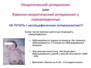 Что такое некротизирующий энтероколит у новорожденных