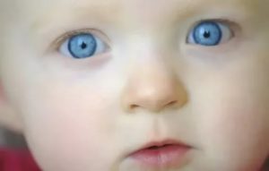 Почему у новорожденного могут быть синяки под глазами