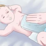 Почему у новорожденных мокрый пупок