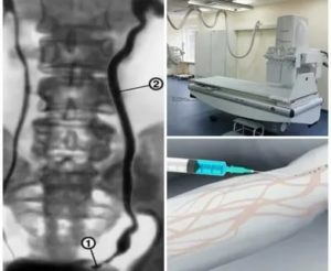 Как делают рентген почки у новорожденного