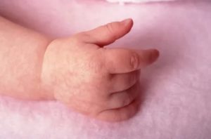 Почему у новорожденного синеют кисти рук