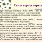 Как избавиться от грудного молока комаровский в домашних условиях