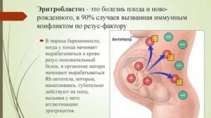 Что такое эритробластоз плода