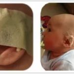 Как делают бронхоскопию новорожденным