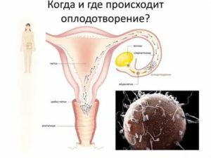 Как происходит искусственное зачатие