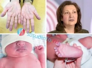 Почему у новорожденного синеют кисти рук