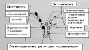 Когда у новорожденных опускаются яички комаровский