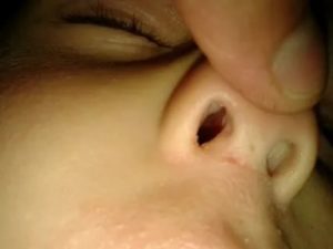 Почему у новорожденных козявки в носу
