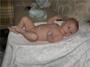 Как должны выглядеть яички у новорожденных мальчиков