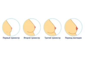 Как меняеться грудь после зачатия