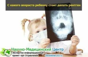 Сколько раз в год можно делать рентген грудному ребенку