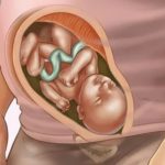 Гормональная поддержка после переноса эмбриона при эко