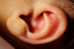 Можно ли сломать ухо новорожденному