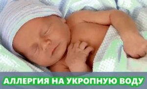 Может ли быть аллергия у грудничков на укропную воду