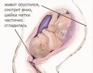 Когда опускается головка плода у повторнородящих