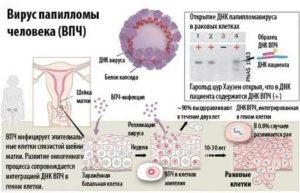 Можно ли беременеть при вирусе папилломы человека 16 типа