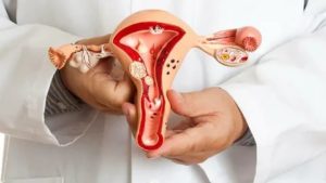 Как эндометриоз влияет на зачатие ребенка у женщин