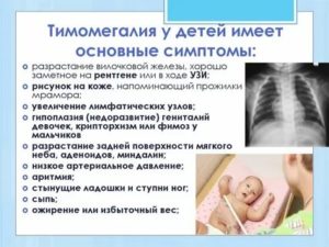 Что такое гиперплазия тимуса у новорожденных