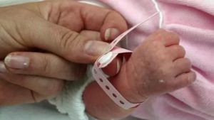 Как снять браслет с руки новорожденного