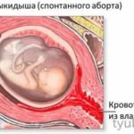 Какие могут быть выделения на 4 недели от зачатия