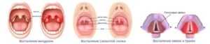 Как проверить горло у грудничков