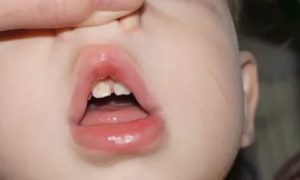 Почему у грудного ребенка желтеют зубы