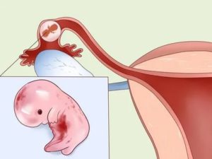 Как беременеют без месячных