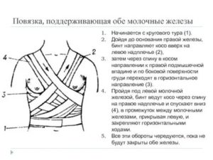 Как правильно перетянуть грудные железы эластичным бинтом