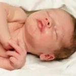 Как делают фгс новорожденному