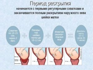 Могут ли родовые схватки быть нерегулярными