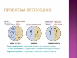 Как понять что ты бесплоден у мужчин в домашних условиях