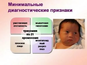 Как диагностировать умственную отсталость у новорожденного