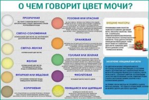 Когда у новорожденного моча становиться желтой