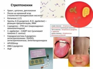 Чем опасен стрептококк для новорожденных