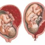 Какие анализы нужно сдать гематологу при планировании беременности