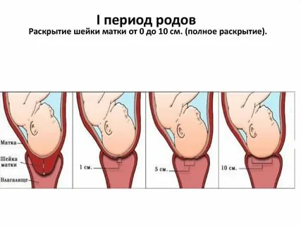 Сколько сантиметров должно быть раскрытие шейки матки при родах