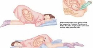 В какой позе нужно спать после родов