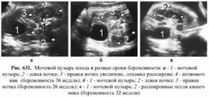 Когда визуализируется мочевой пузырь у плода