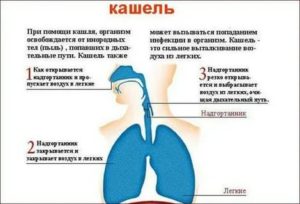 Может ли кашлять грудничок от сухого воздуха