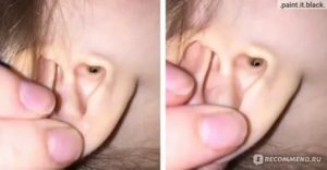 Почему у грудного ребенка запах из ушей