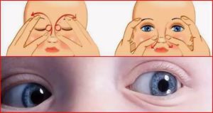 Как делать массаж глаз у новорожденных при коньюктивите