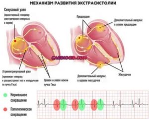 Что такое бигеминия плода