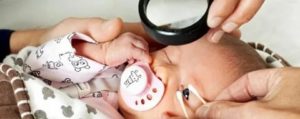 Что проверяет офтальмолог у новорожденных