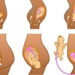 Гинекологический массаж при планировании беременности