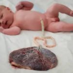 Если эмбрион отстает в развитии при эко на ранних сроках есть ли шанс