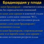 Зачем ставят капельницу с окситоцином при родах