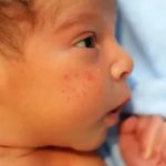 Что такое у новорожденных электролиты