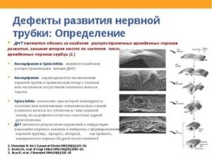 Что такое высокий риск дефекта нервной трубки у плода